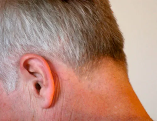 grey-hair grey hair
